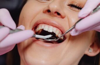 Swollen Gums: Everything to Know about It and Treatment Swollen gums treatment