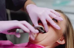 3rd Molar Extraction: Everything You Need to Know About It 3rd molar extraction